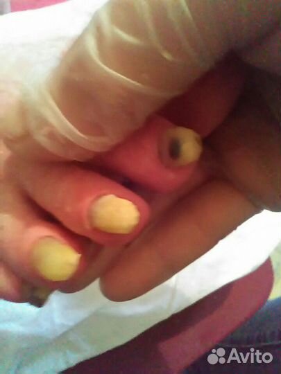 Педикюр для пожилых людей.Выезд во все районы