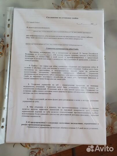 Набор для установки скайсов