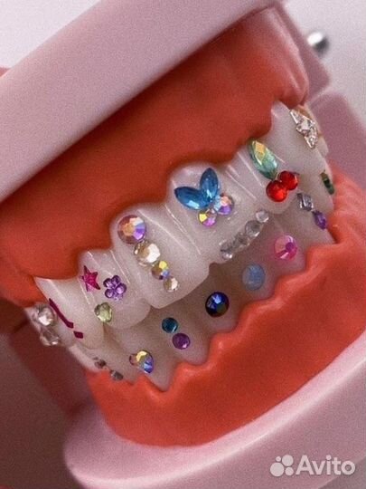 Установка Скайсов