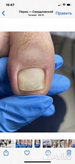 Услуги подолога