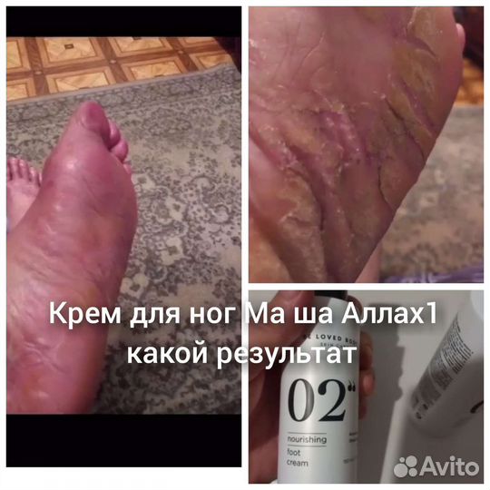 Продукция NL