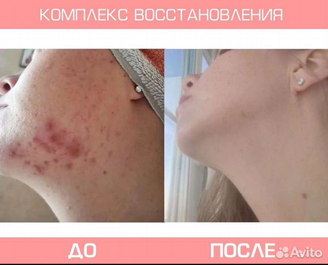 Висцеральный массаж по методу А.Т.Огулова