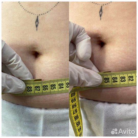 Массаж коррекция фигуры