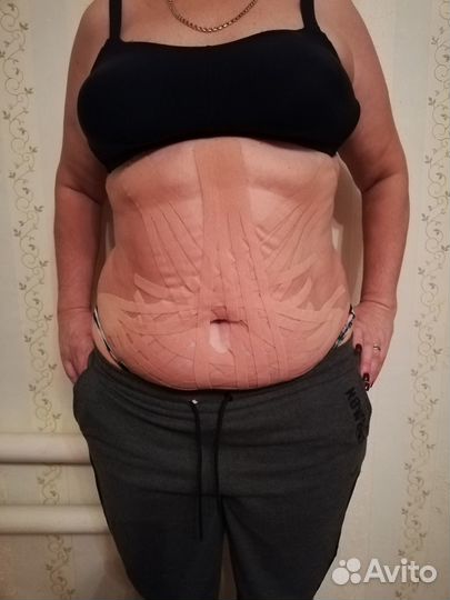 Эстетическое тейпирование лица и тела