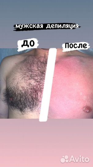 SPA-шугаринг