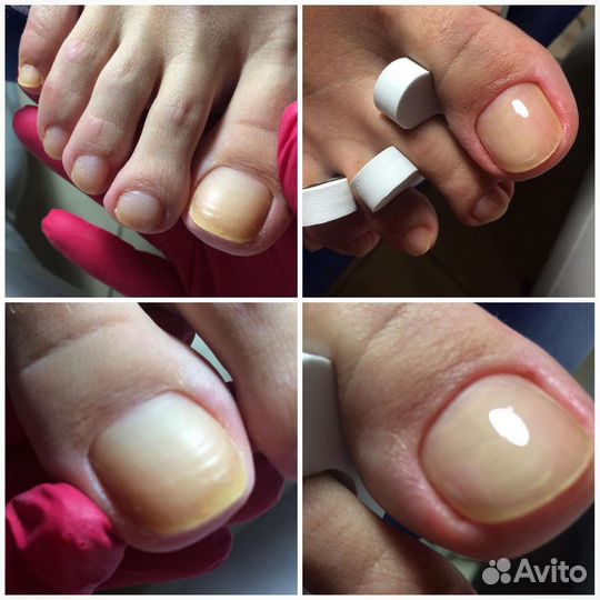 Маникюр педикюр