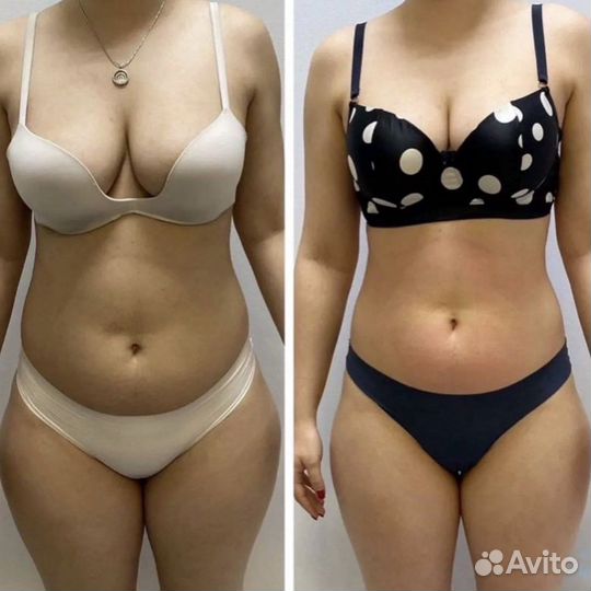 Массаж LPG коррекция фигуры