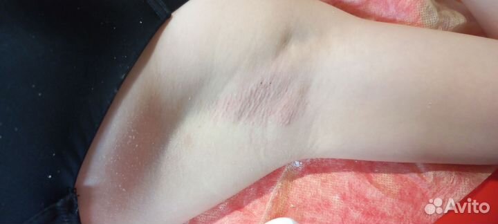 Шугаринг Ваксинг