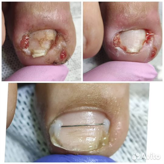 Высококвалифицированный подолог в Ялте