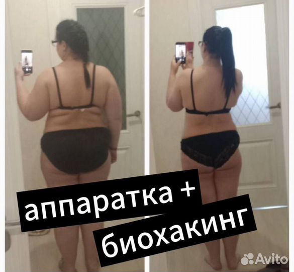 Массаж антицеллюлитный Коррекция фигуры