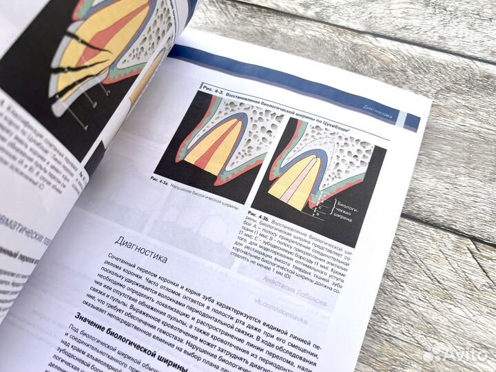 Травма зубов