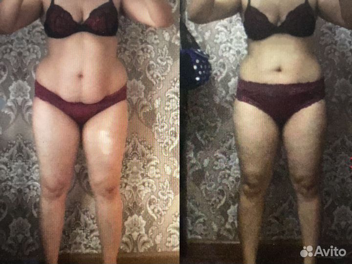 Консультация диетолога