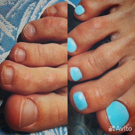 Педикюр наращивание маникюр