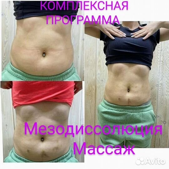 Антицеллюлитный массаж ручной коррекция фигуры