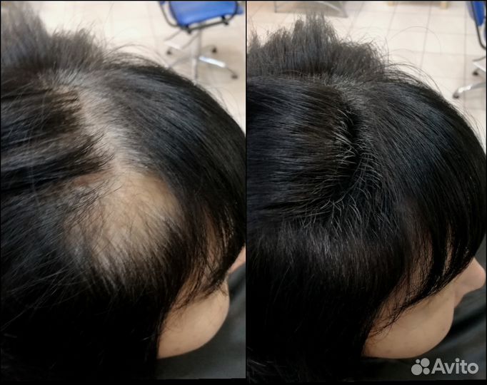 Загуститель для волос