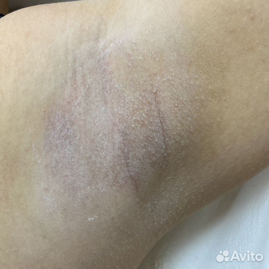 Депиляция и шугаринг