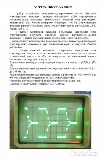 Электронейростимулятор