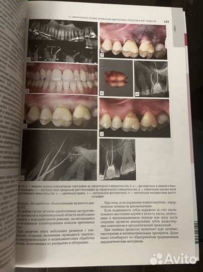 Хирургическая стоматология.Учебник