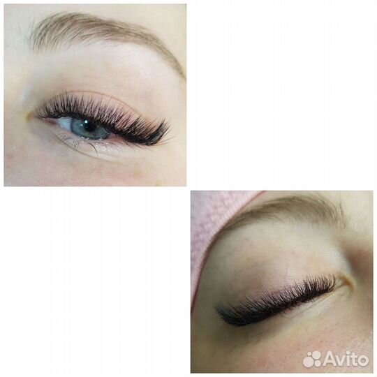 Брови, ресницы