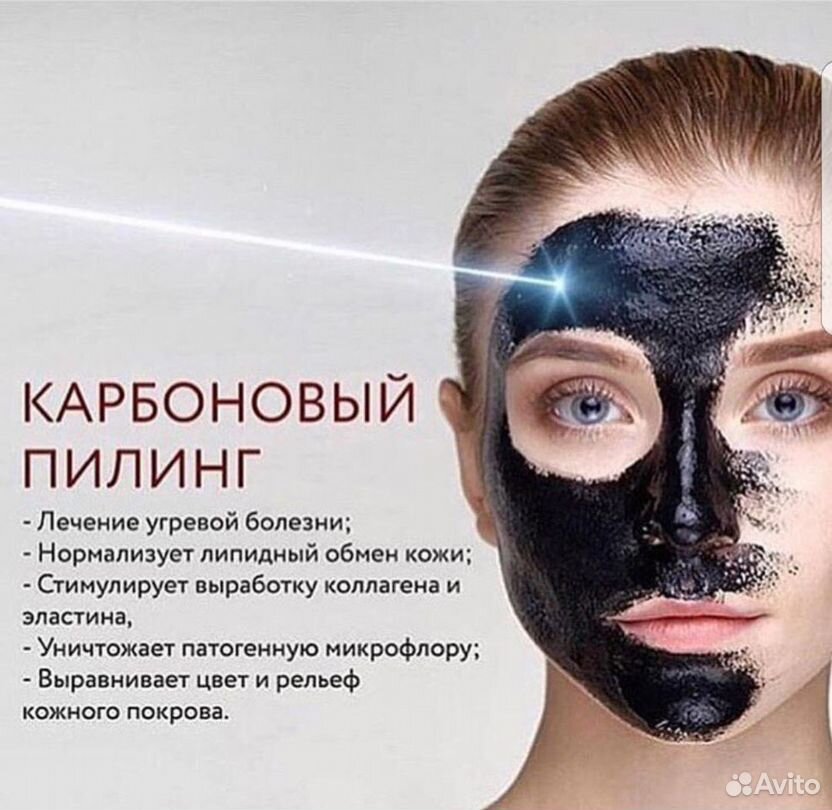 Карбоновый пилинг