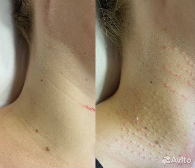 Обучение косметологии, инъекции, плазма, эстетика