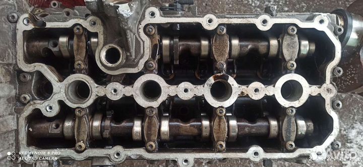 Гбц левая правая,и многое другое