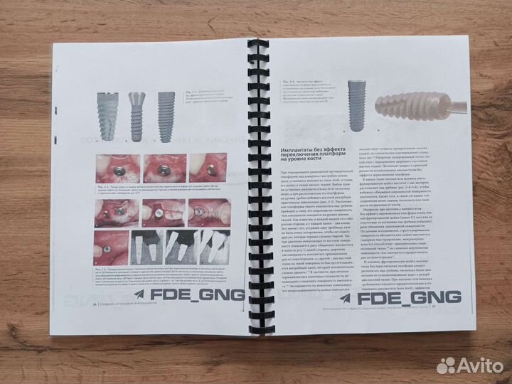 Нулевая утрата кости хирургия