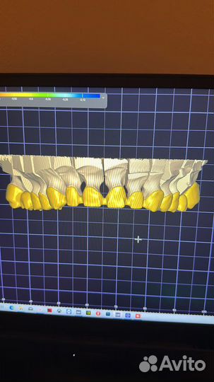 3d моделирование зубов в exocad