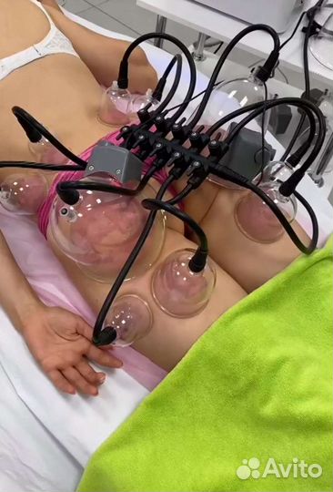 LPG массаж/вакуумный/антицеллюлитн баночный массаж