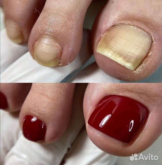 Педикюр сормово