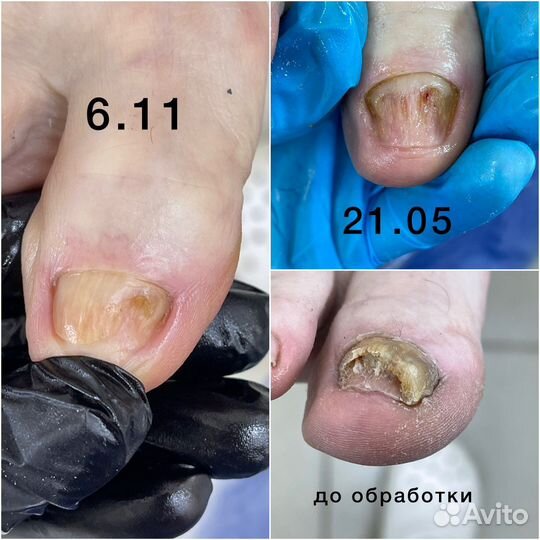 Педикюр серпухов