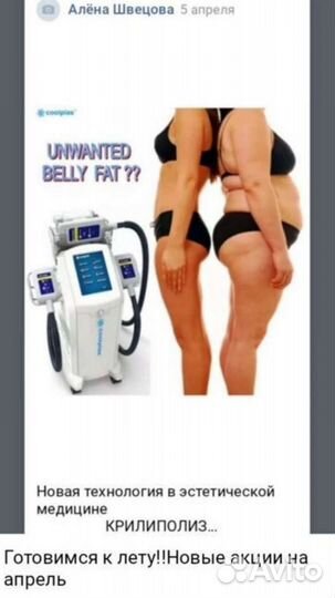 Процедура криолиполиз