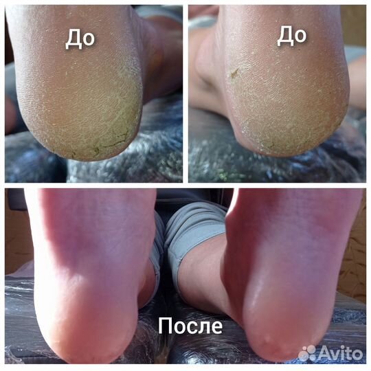 Smart педикюр