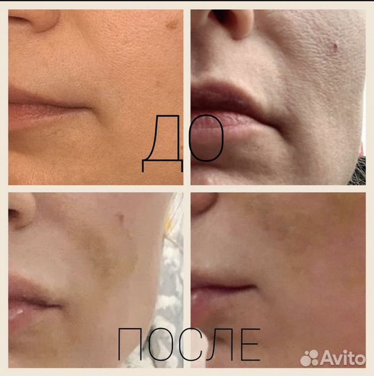 Врач косметолог