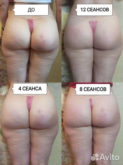 Депиляция, массаж, ламинирование