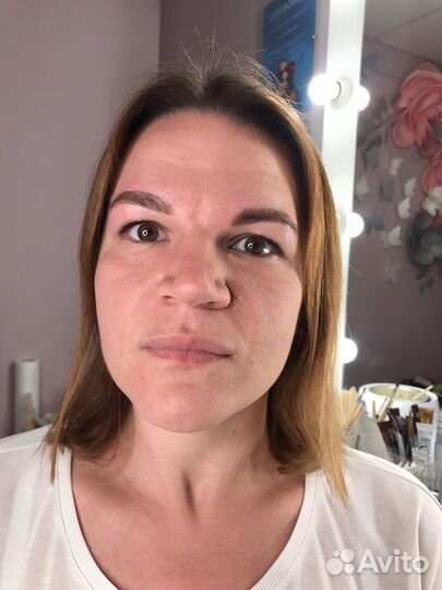 Косметолог брови чистка пилинг дермопен