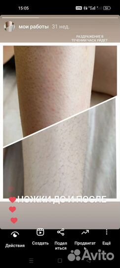 Мастер депиляции