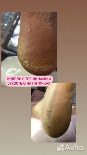 Модель на педикюр