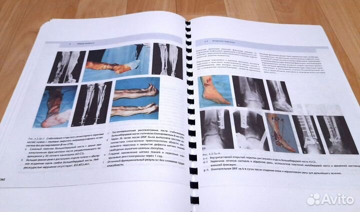 Книги по травматологии