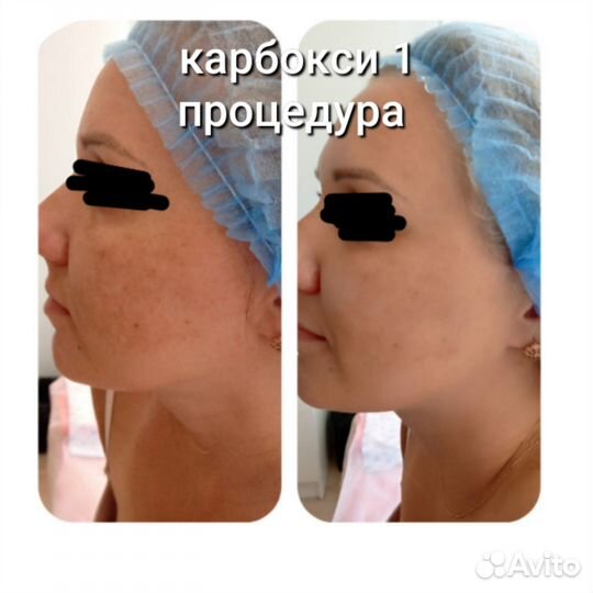 Массаж лица + маска