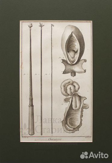 Старинная гравюра «Хирургия» - 15