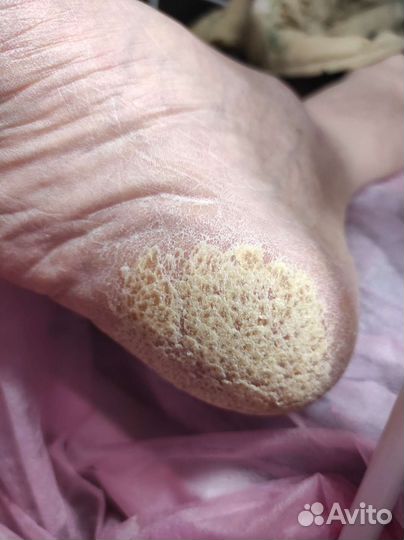 Услуги подолога. Педикюр эстетика