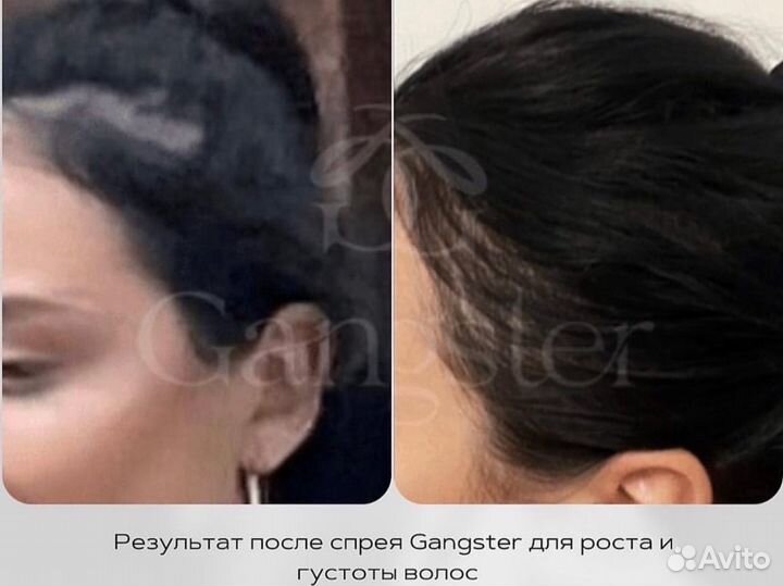 Спрей против Выпадения и для Роста волос