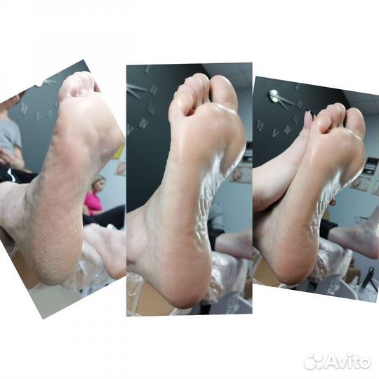 Смарт педикюр