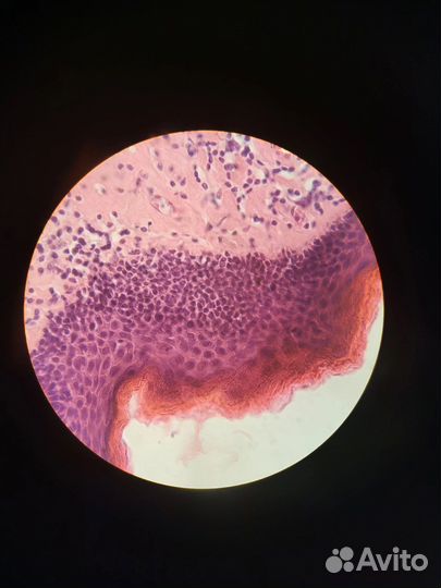 Изготовление гистологических препаратов