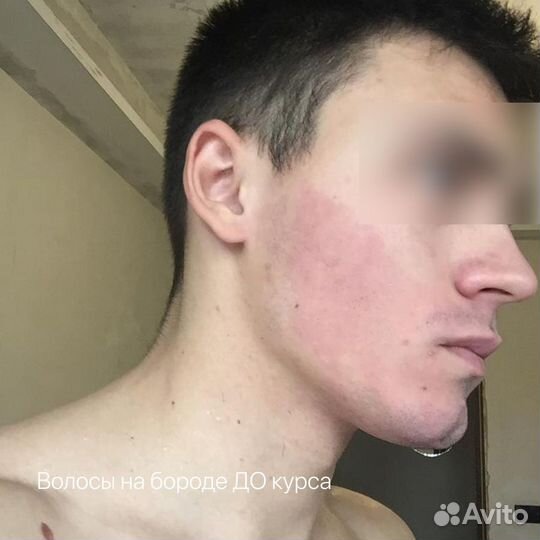 Набор для роста волос