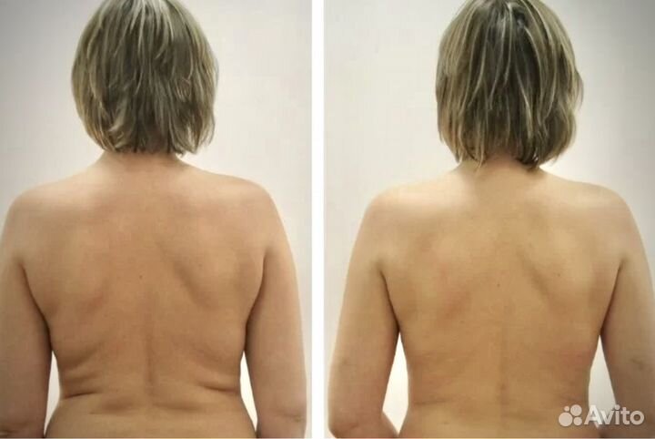 Массаж на дому