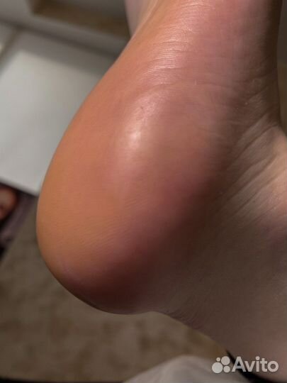 Педикюр Smart