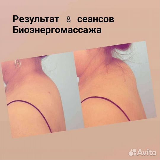 Массаж лечебный /реабилитационный биотоками