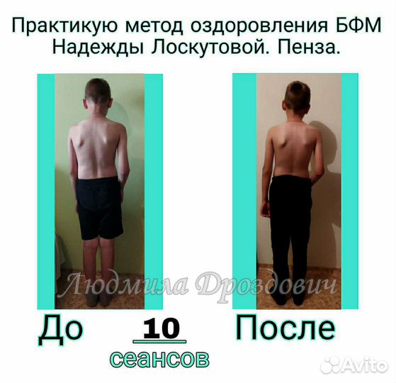 Биодинамический фасциальный массаж